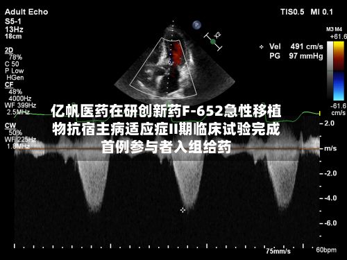 亿帆医药在研创新药F-652急性移植物抗宿主病适应症II期临床试验完成首例参与者入组给药-第1张图片